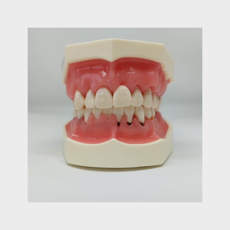 Model til trning af parodontale behandlingsteknikker 